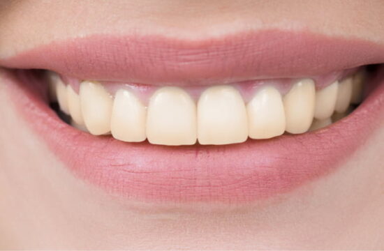 Before (Teeth)